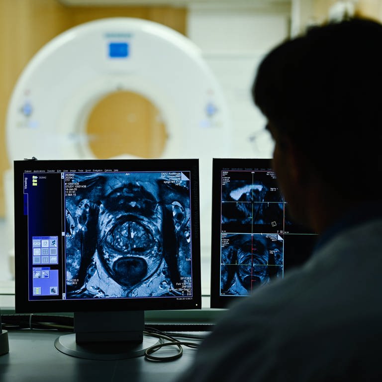 Ein Mitarbeiter betrachtet in einem Kontrollraum das Querschnittsbild einer Prostata. Gutartige Prostatavergrößerung: So kann man sie behandeln
