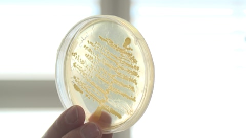 Petri-Schale mit Bakterien