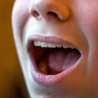 Der geöffnete Mund eines zwölfjährigen Jungen (Foto: dpa Bildfunk, picture alliance/dpa/dpa-Zentralbild | Jens Büttner)