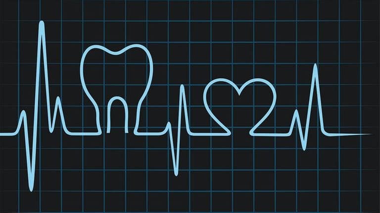 Eine animierte Herzlinie auf einem Herzmonitor zeigt einen Zahn und ein Herz an, dazwischen normale Herztöne. (Foto: Getty Images, Thinkstock -)