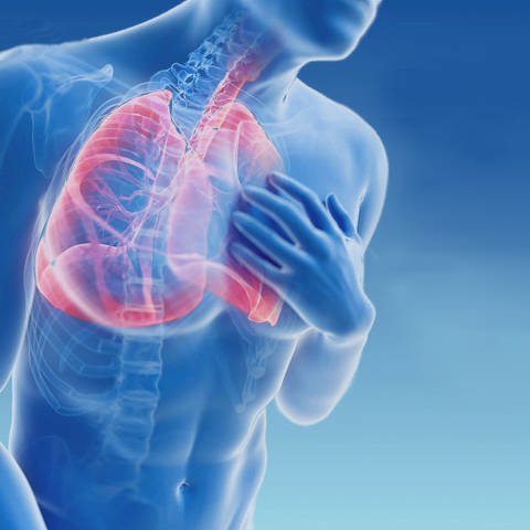 Grafik mit Lunge, Skelett und gekennzeichneten Bronchien (Foto: SWR)