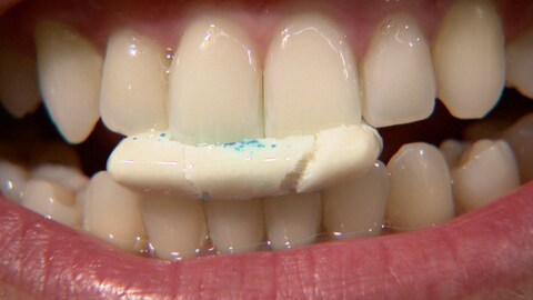 Kaugummi regt die Speichelproduktion im Mund an und unterstützt so die Zahnpflege (Foto: SWR)