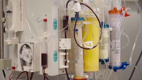 Noch in der Erprobung und nicht unumstritten: Verschiedene Methoden der Blutreinigung, um Long COVID zu therapieren (Foto: SWR)