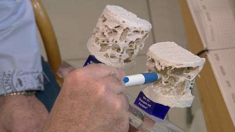 Arzt demonstriert Knochenschwund. Intakte Knochesubstanz neben porösem Exponat (Foto: SWR)
