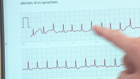 EKG - Diagramm, Arzt zeigt auf Impuls-Spitzen in der Messung (Foto: SWR)