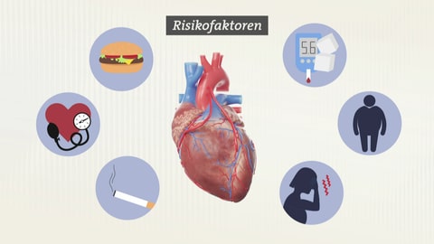 Grafik, die Risikofaktoren für einen Herzinfarkt zeigt. Zum Beispiel Rauchen oder Übergewicht
