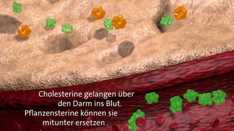Eine Grafik zeigt, wie Pflanzensterine Cholesterin ersetzen können. (Foto: SWR)