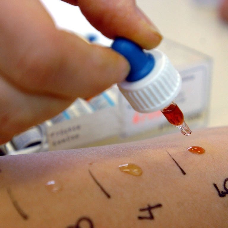 Bei einem Allergie-Test werden Substanzen auf die Haut einer Patientin aufgetragen. (Foto: SWR)