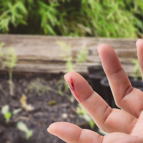 Eine Person hat sich in den Finger geschnitten. Im Hintergrund ein Gemüsebeet. (Foto: Colourbox; Unsplash/ Markus Spiske; Collage SWR)