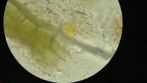 Unter dem Mikroskop sind die Drüsenschuppen besonders gut erkennbar, die mit ätherischen Ölen gefüllt sind und dem Thymian sein typisches Aroma verleihen.  (Foto: SWR)