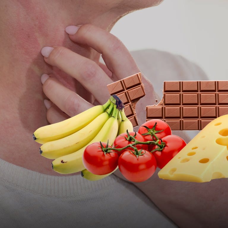 Eine Person kratzt sich am Hals, der leicht gerötet ist. Daneben sind Bananen, Käse, Tomaten und Schokolade zu sehen. (Foto: Adobe Stock / thodonal, by-studio, gitusik, ImagesMy, KostaKostov)