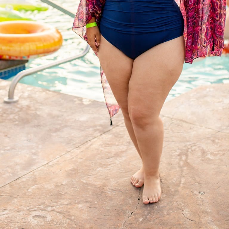 Eine korpulente Frau mit blauem Badeanzug posiert am Strand. Überproportional dicke Beine im Vergleich zum restlichen Körper können durch ein Lipödem bedingt sein. (Foto: Unsplash / AllGo- An App For Plus Size People)