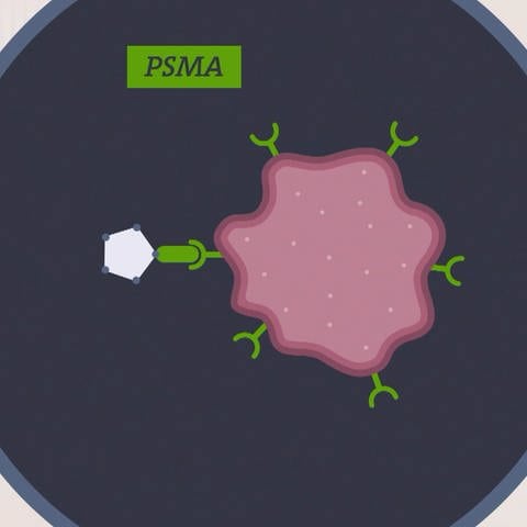 Schema PSMA (Foto: SWR)