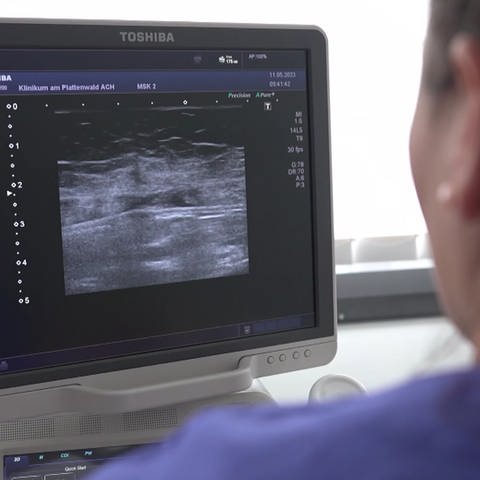 Ein Ultraschall (Foto: SWR, SWR)