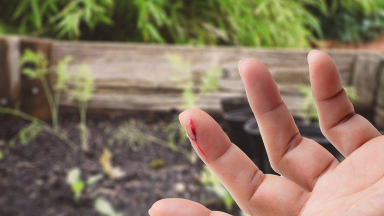 Eine Person hat sich in den Finger geschnitten. Im Hintergrund ein Gemüsebeet. Ein Kratzer auf der Haut durch Gartenarbeit, ein entzündlicher Mückenstich - selbst kleine Verletzungen können eine gefährliche Blutvergiftung, eine Sepsis, entwickeln. (Foto: Colourbox, Colourbox; Unsplash/ Markus Spiske; Collage SWR)