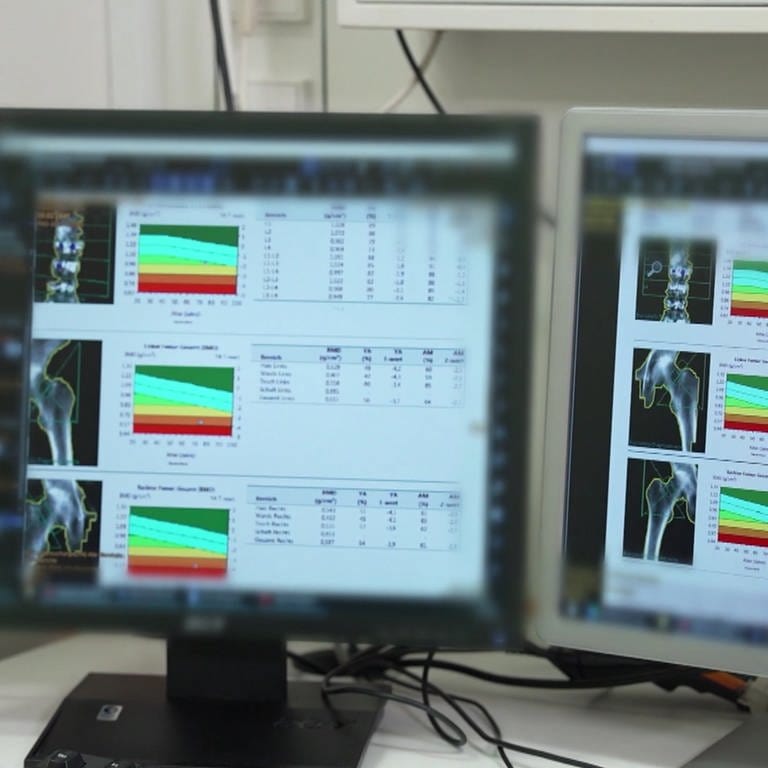 Arzt vor Bildschirmen mit Röntgenaufnahmen (Foto: SWR)