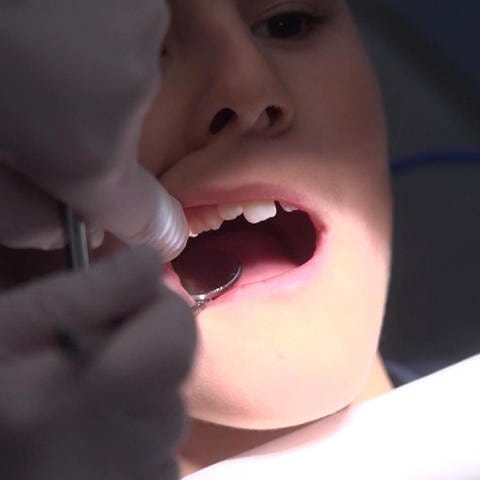 Zahnfleischuntersuchung bei einem Jungen (Foto: SWR)