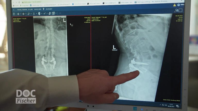 ein Arzt erklärt einer Patientin anhand einer Röntgenaufnahme einen erfolgten Eingriff an der Wirbelsäule (Foto: SWR)