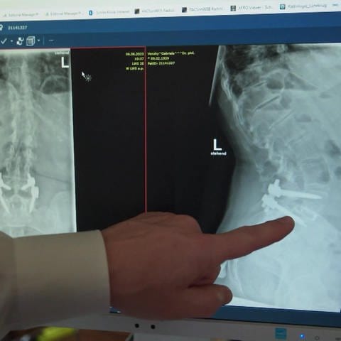 ein Arzt erklärt einer Patientin anhand einer Röntgenaufnahme einen erfolgten Eingriff an der Wirbelsäule