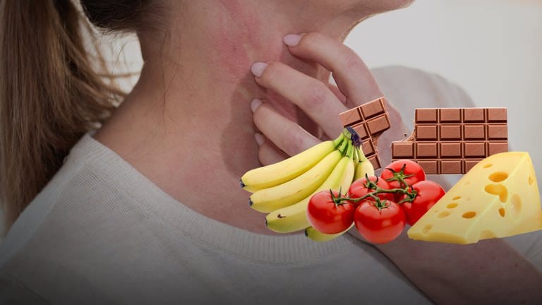 Eine Person kratzt sich am Hals, der leicht gerötet ist. Daneben sind Bananen, Käse, Tomaten und Schokolade zu sehen.