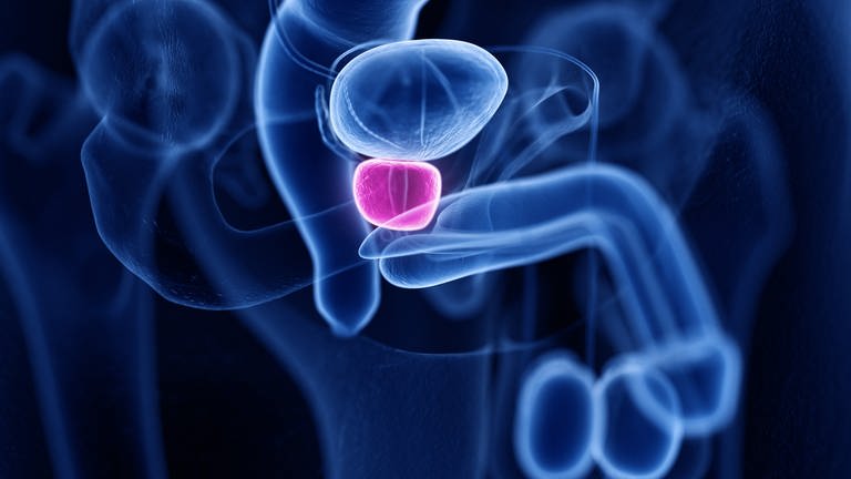 Prostatakrebs behandeln mithilfe der PSMA-Therapie? Darstellung inneren männlichen Geschlechtsorgane mit Markierung der Prostata zwischen Harnblase und dem Beckenboden - Darstellung ähnliches eines Röntgen-Bildes (Foto: Adobe Stock, AdobeStock/SciePro)
