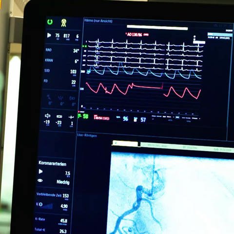 Medizinsches Gerät zur Überwachung der Herzfrequenz (Foto: SWR)