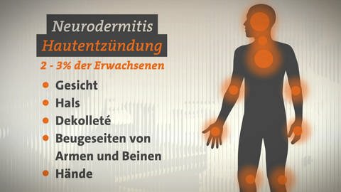 Grafische Darstellung eines Menschen mit besonders häufig von Entzündungen aufgrund von Neurodermitis betroffenen Körperstellen. Etwa 2 bis 3 Prozent der Erwachsenen sind von Neurodermitis betroffen.