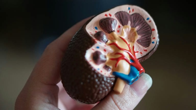 Man sieht das Modell einer Niere, die in der Hand gehalten wird. (Foto: Unsplash)